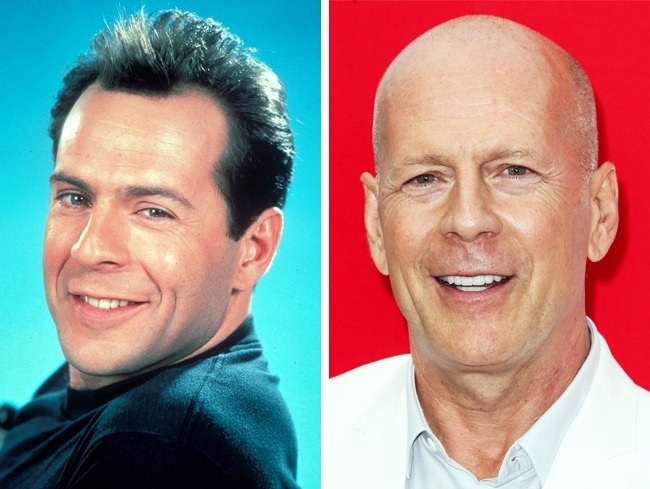 Bruce Willis - Calvicie antes e depois